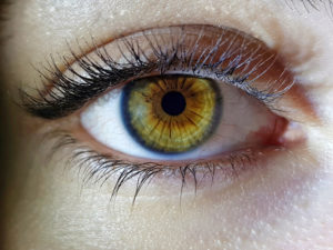 cataracta